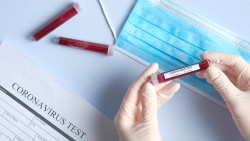 Corona-Virus Informationen zu laufenden Förderungen